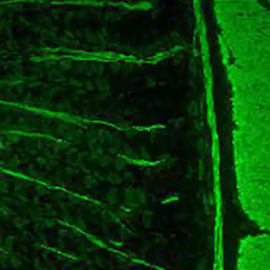 anti smooth muscle antibodies test
